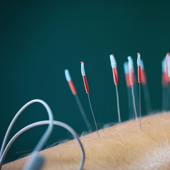 How many sessions are recommended for optimal results?