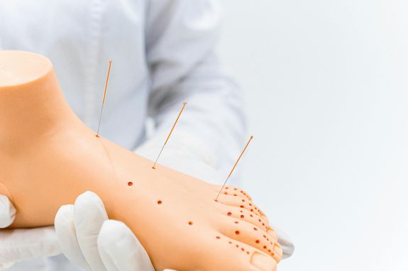 Is acupuncture safe?