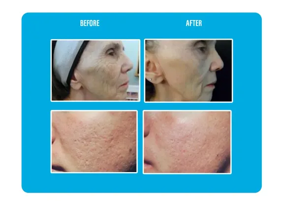 How long before i see results?