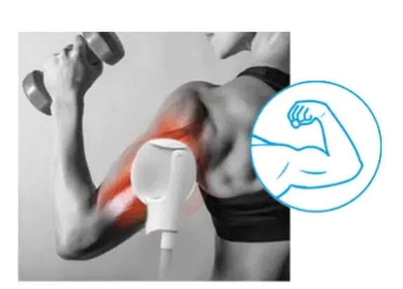 Is there any downtime after the treatment?