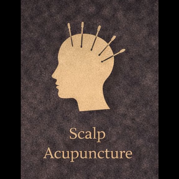 Scalp Acupuncture