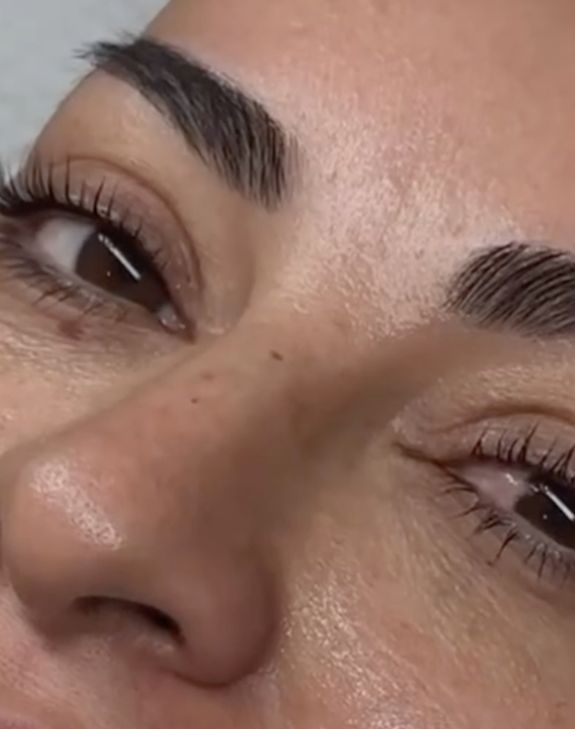 Improves Skin Texture and Tone