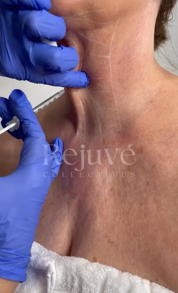 Non-Surgical & Minimally Invasive