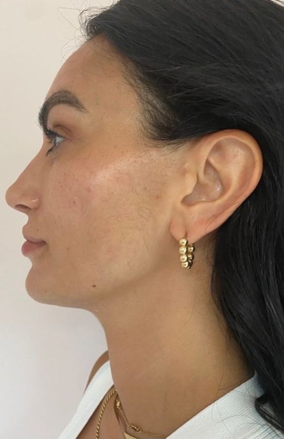 Subtle, Gradual Enhancement