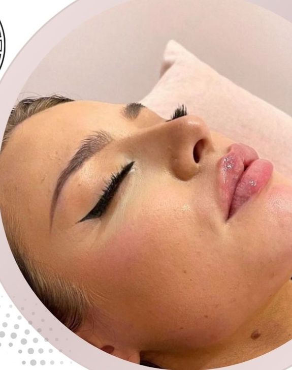 Minimizes Acne Scars and Enlarged Pores