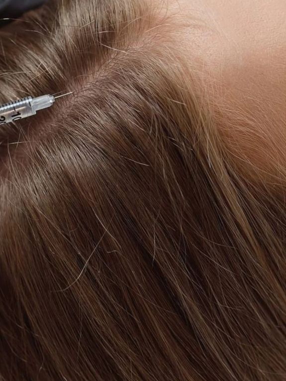 Exosome Therapy: Advanced Skin Rejuvenation and Repair