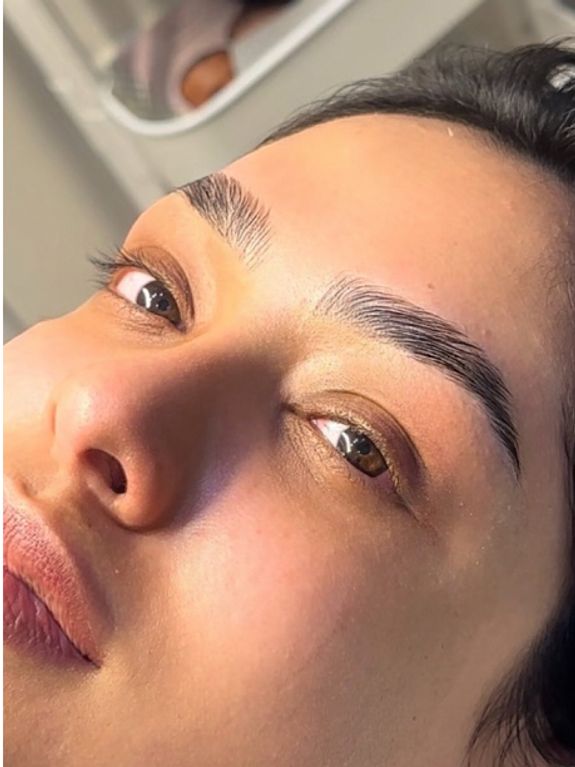 Reduces Acne & Inflammation