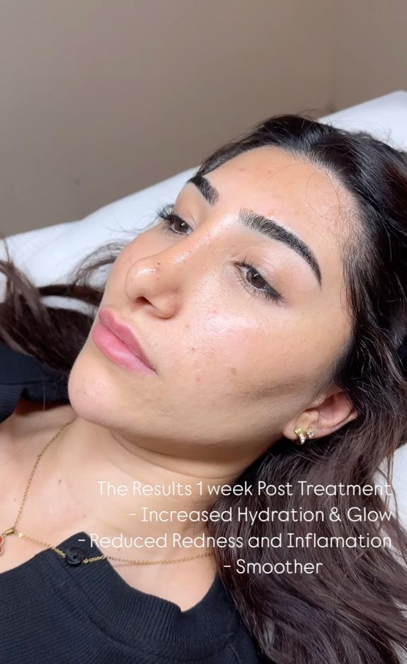 Stimulates Natural Collagen Production