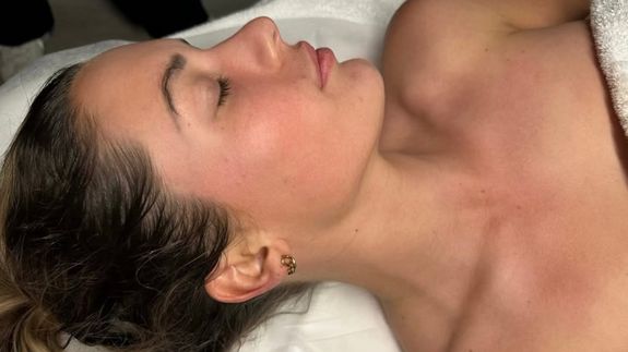 Boost Collagen, Repair Skin, and Restore Radiance with Exosome Therapy at Rejuve Collective