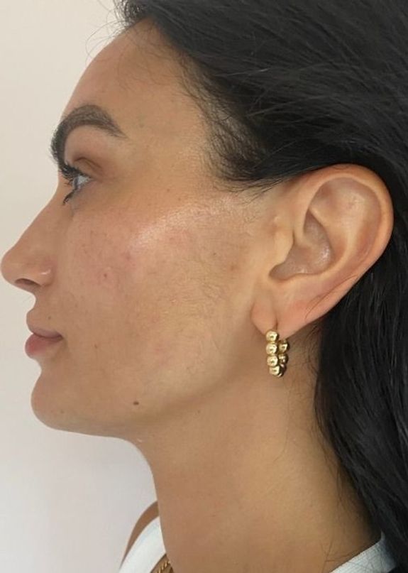 Instantly Brighter, Smoother Skin