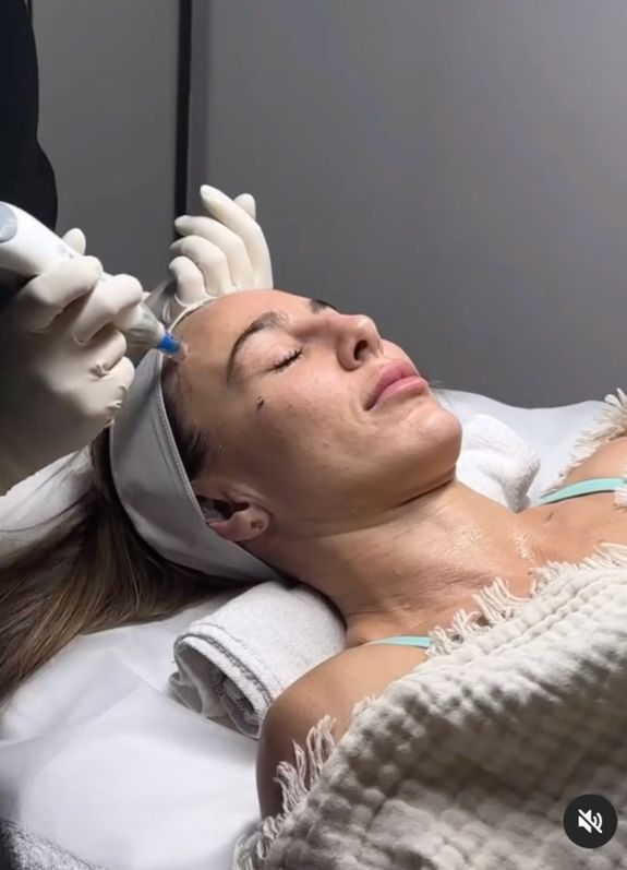 Dermapen and Chemical Peels: Advanced Skin Renewal Treatments