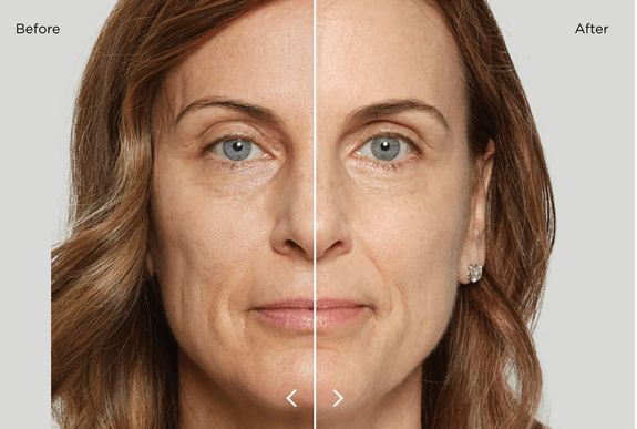 Reveal the Skin You Forgot You Had – Rejuvenate, Restore, and Radiate Confidence