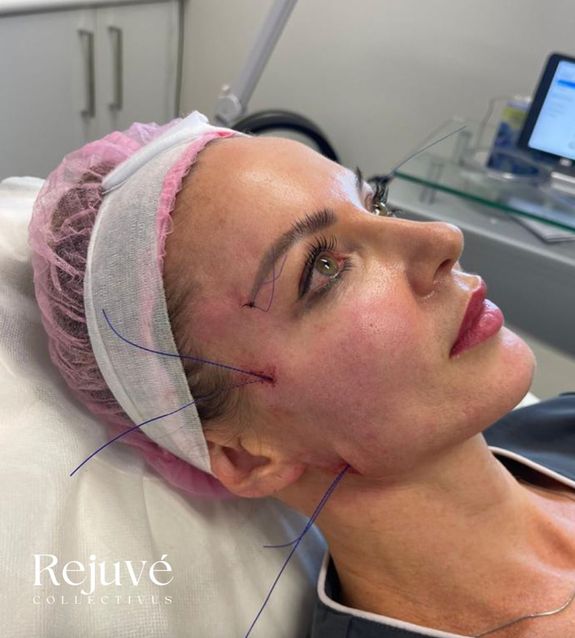 Cost-Effective Alternative to Surgery