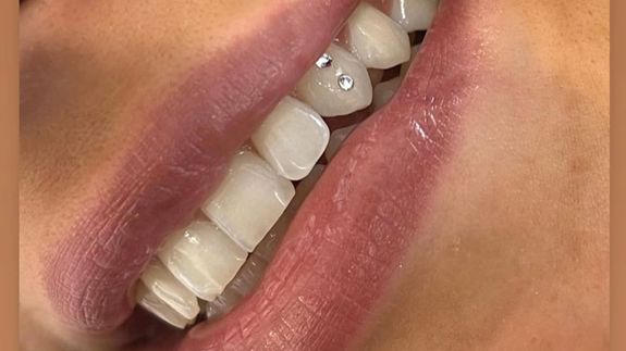 Ready to Shine? Schedule Your Smile Makeover