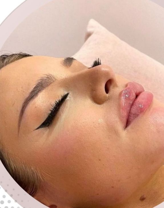 Enhances Skin Clarity and Glow